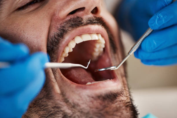 Best Pediatric Emergency Dentist in Sachse, TX